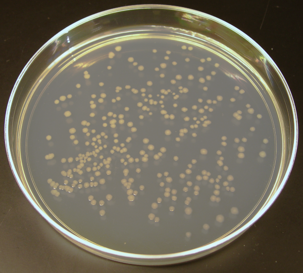 Colonies of bacterial E. coli cells on an agar plate. Each colony consists of millions of bacteria.